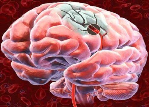 뇌 혈류를 증가시키는 5가지 방법