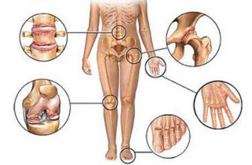 팔다리 통증, 원인이 무엇일까?