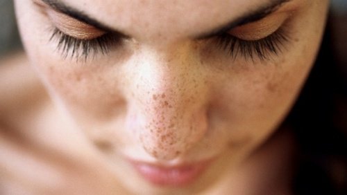 얼굴 잡티를 제거하는 6가지 천연 치료제