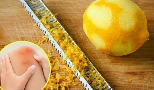 레몬 껍질로 관절통을 치유하는 방법