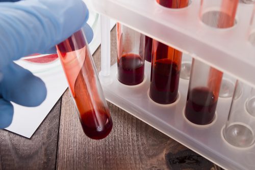 혈액 검사로 암을 조기에 발견할 수도 있다!