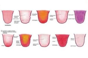 혀가 건강에 대해서 알려주는 9가지
