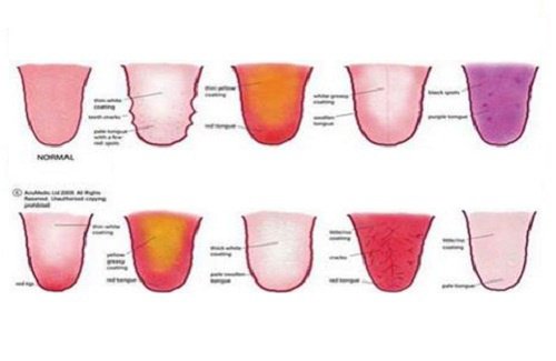 혀가 건강에 대해서 알려주는 9가지