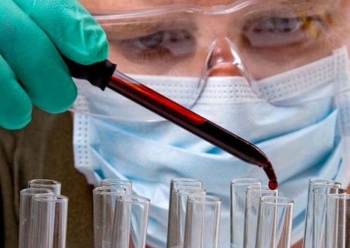 암 세포 조기 발견을 돕는 간단한 혈액 검사