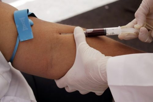 암 세포 조기 발견을 돕는 간단한 혈액 검사 
