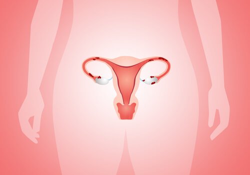 자궁 폴립 부정출혈의 원인은 무엇인가?