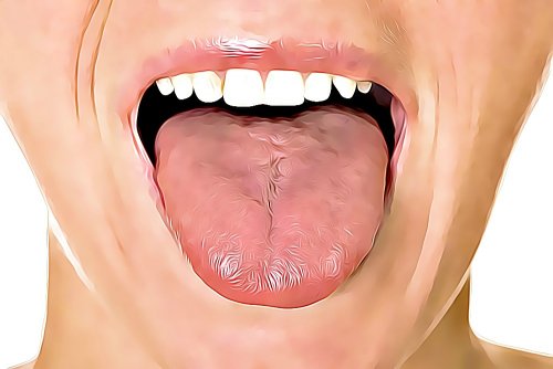 혀 궤양을 위한 홈 치료법 6가지
