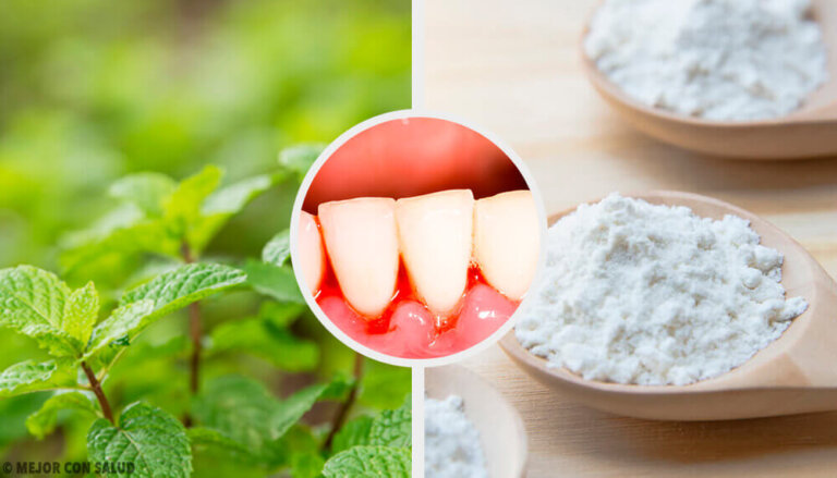 치은염에 효과적인 5가지 자가 요법