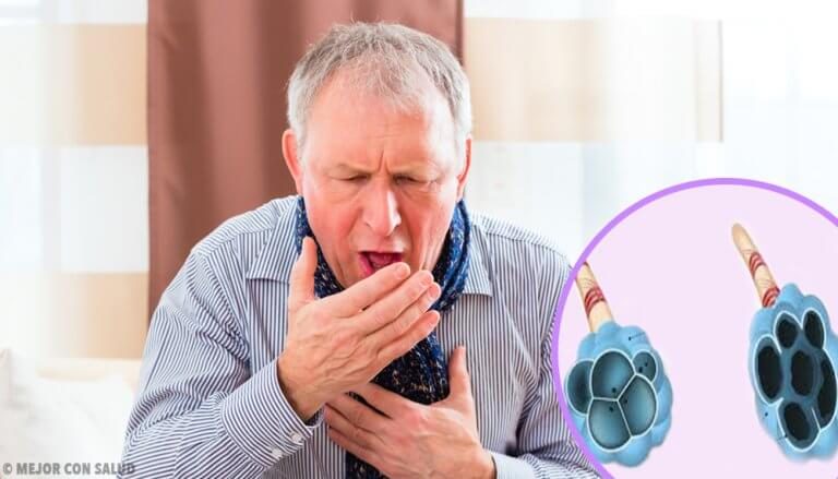 만성 폐쇄성 폐질환(COPD)에 관하여