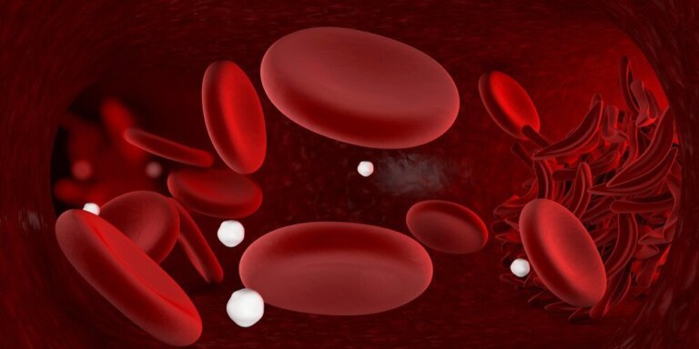 빈혈이 생기는 원인과 빈혈 자연 요법