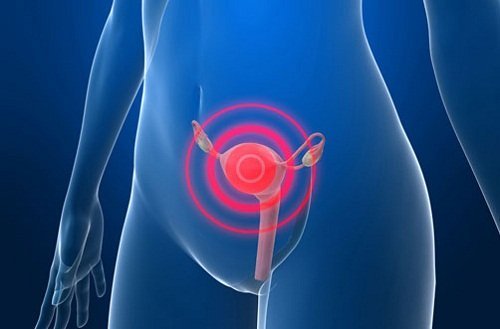 자궁경부암검사는 자궁경부염발견에 도움이 된다.