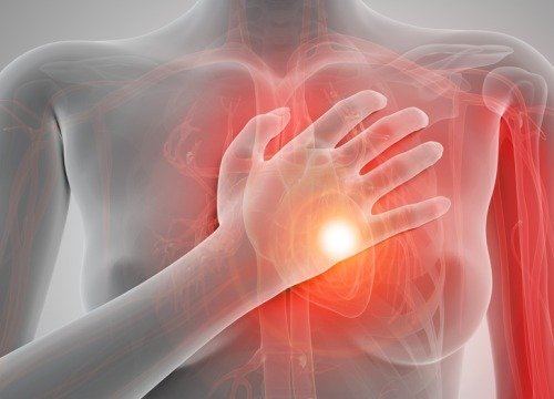 심장 마비를 경고하는 8가지 증상