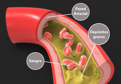 콜레스테롤 수치를 줄이는 자연 요법 6가지 동맥