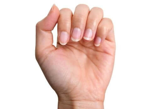 황색 손톱을 자연적으로 치료하는 방법