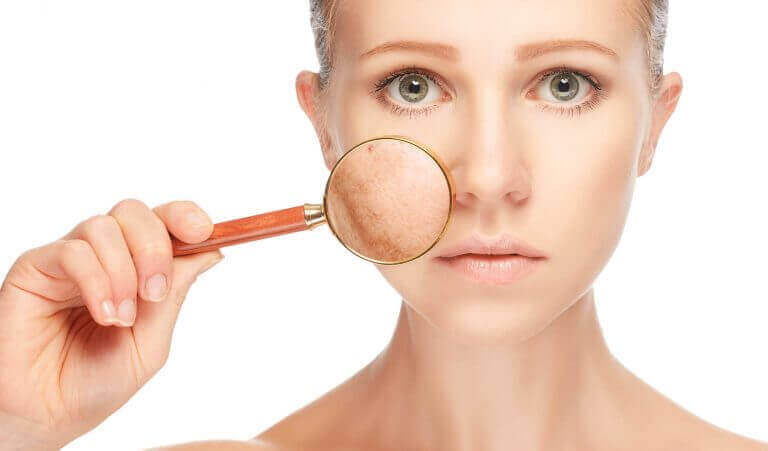 가장 흔한 얼굴 피부 트러블과 치료 방법
