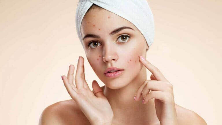 가장 흔한 얼굴 피부 트러블과 치료 방법