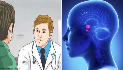 뇌하수체 선종은 어떤 병일까?