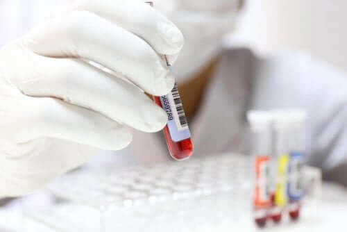 얼마나 자주 혈액 검사를 받아야 할까?