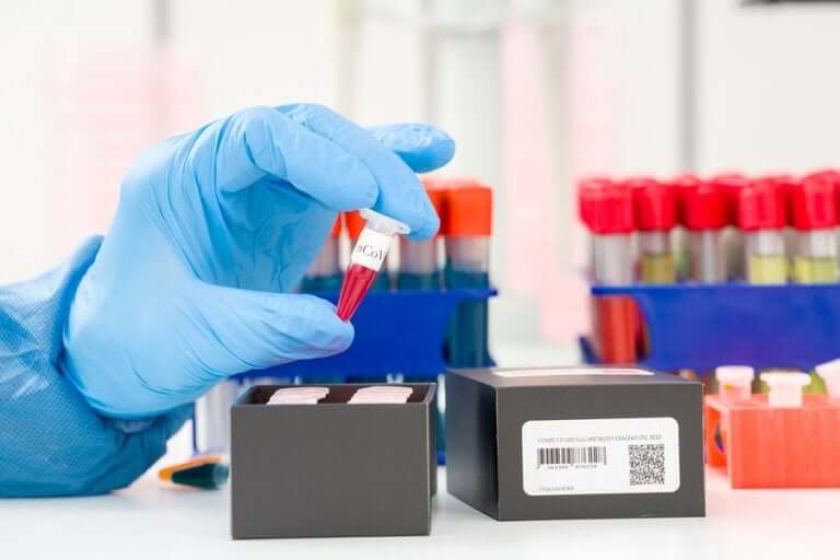 코로나바이러스 검출을 위한 PCR 검사