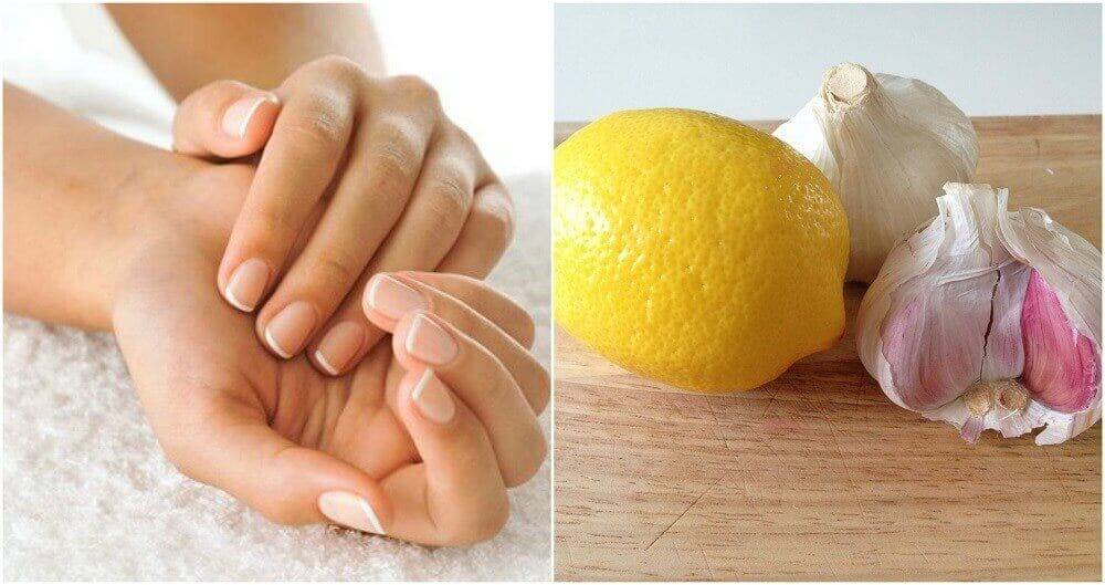 마늘과 레몬으로 손톱을 강화하는 방법