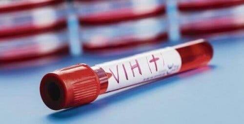 HIV 골수 이식