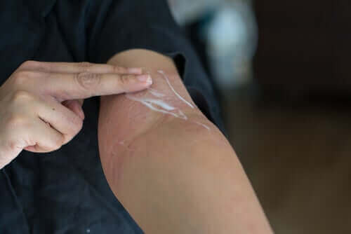 피부 발진: 증상, 원인 및 치료