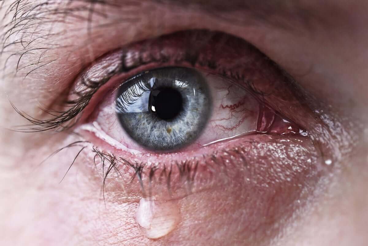 눈물 젖은 눈에는 어떤 종류가 있을까?
