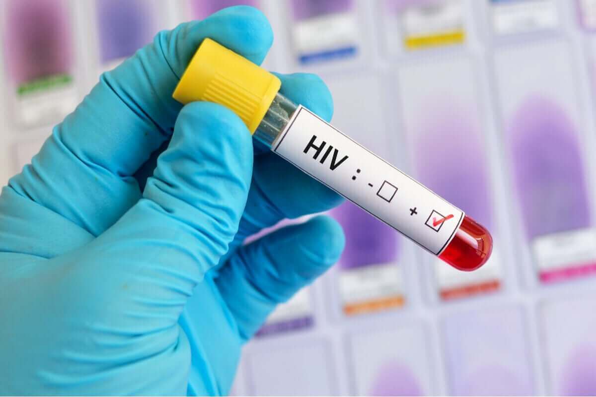 HIV 전염에