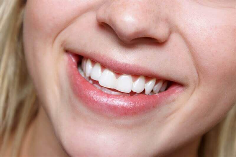 치아 미백을 위한 자연 요법