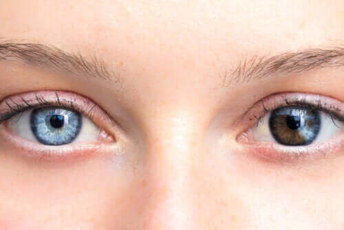 눈 색깔의 변화로 알 수 있는 건강 상태