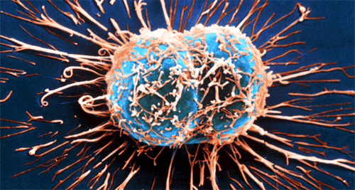 면역계가 암과 싸우는 방식