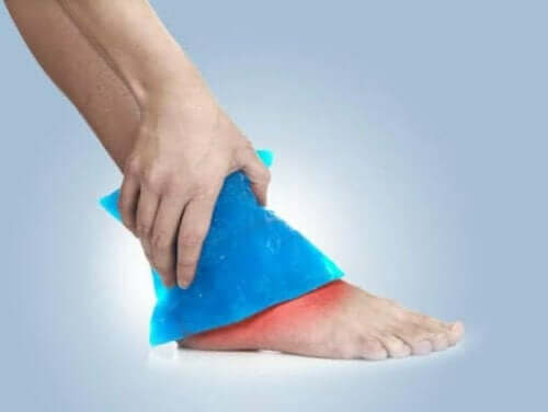 발목 염좌 치료를 위한 보완 요법