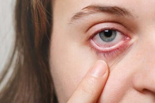 눈 감염에 효과적인 5가지 치료법