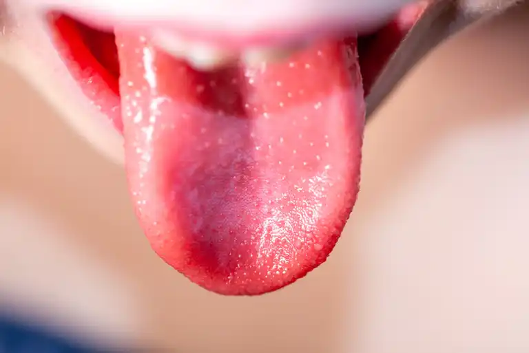 혀를 보면 건강과 감정 상태를 알 수 있다
