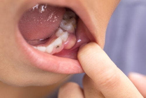 몸으로 퍼진 치아 감염 증상