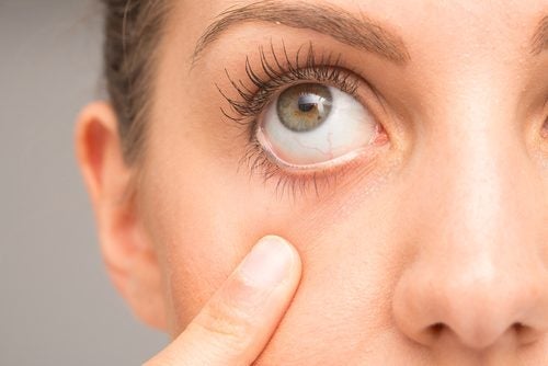 눈 틱 장애 치료를 돕는 방법 7가지