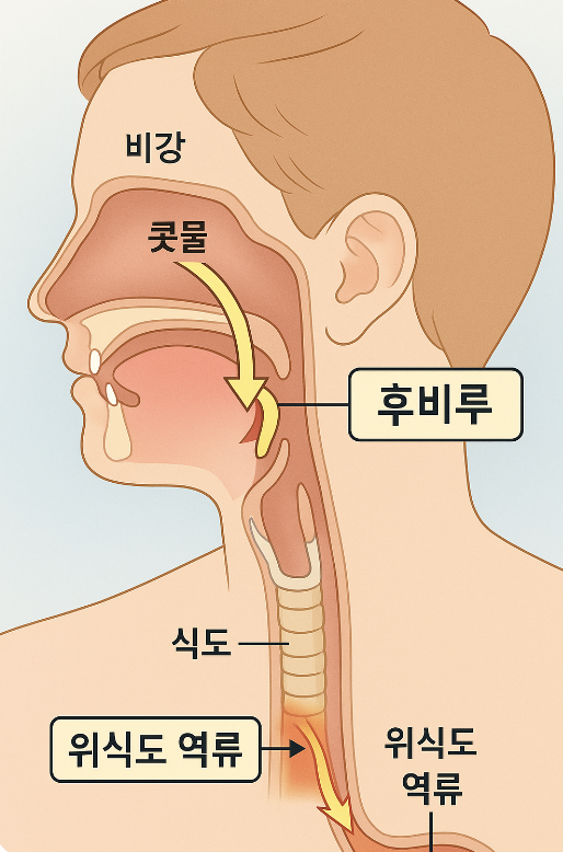 가래가 생기는 이유와 원인